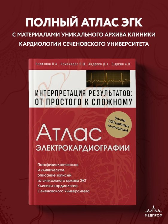 Атлас электрокардиографии. Интерпретация результатов: от простого к сложному