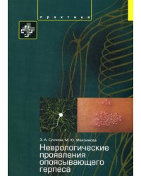 Неврологические проявления опоясывающего герпеса. Пособие для врачей