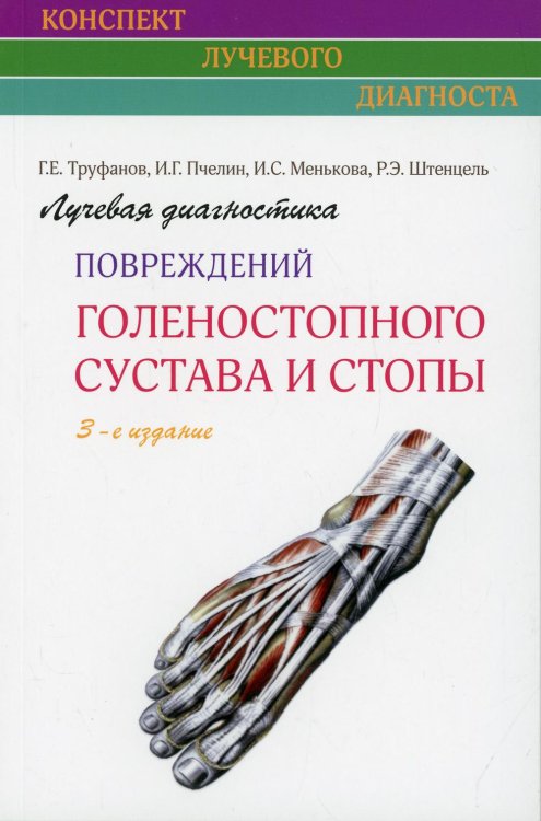 Лучевая диагностика повреждений голеностопного сустава и стопы