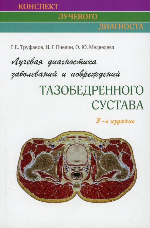 Лучевая диагностика заболеваний и повреждений тазобедренного сустава. Руководство