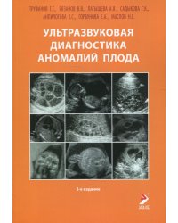 Ультразвуковая диагностика аномалий плода. Руководство для врачей