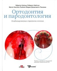 Ортодонтия и пародонтология. Комбинированные стратегии лечения