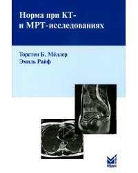 Норма при КТ- и МРТ-исследованиях. 6-е изд