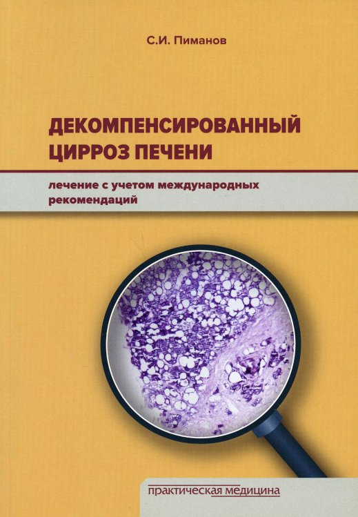 Декомпенсированный цирроз печени. Лечение с учетом международных рекомендаций