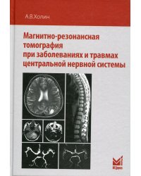 Магнитно-резонансная томография при заболеваниях и травмах центральной нервной системы. 2-е изд