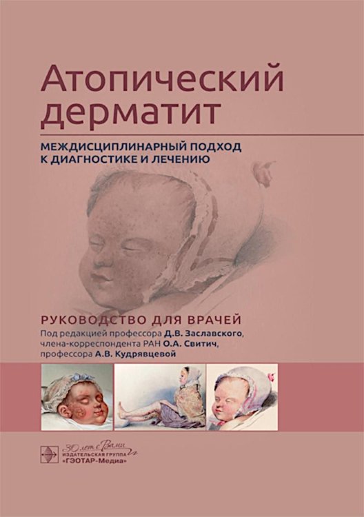 Атопический дерматит. Междисциплинарный подход к диагностике и лечению: руководство для врачей