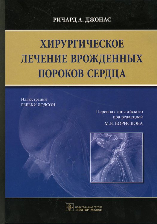 Хирургическое лечение врожденных пороков сердца