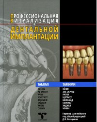 Профессиональная визуализация в дентальной имплантации