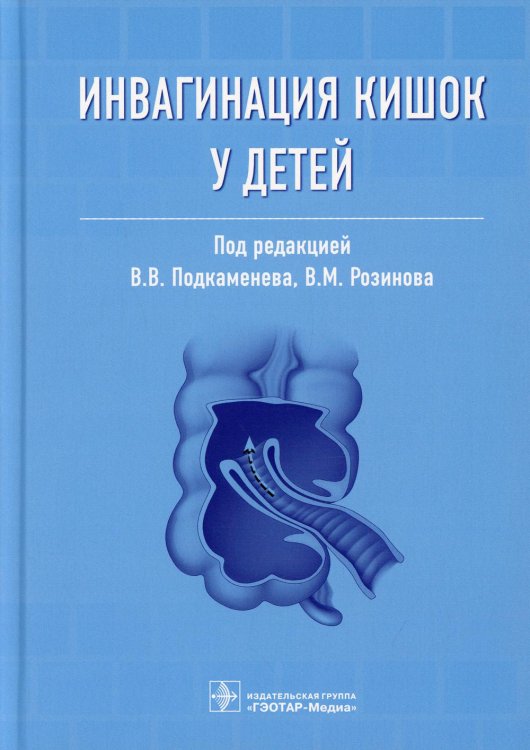 Инвагинация кишок у детей. Руководство