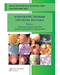 Доброкачественные опухоли желудка. Ч. 1: Эпителиальные опухоли и опухолеподобные поражения: Учебно-методическое пособие. 2-е изд., испр. и доп