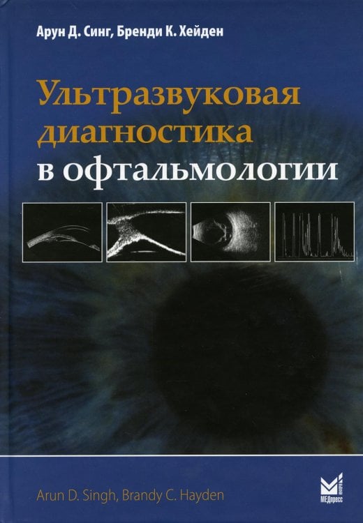 Ультразвуковая диагностика в офтальмологии