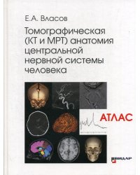 Томографическая (КТ и МРТ) анатомия центральной нервной системы человека. Атлас