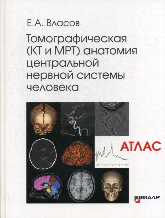 Томографическая (КТ и МРТ) анатомия центральной нервной системы человека. Атлас