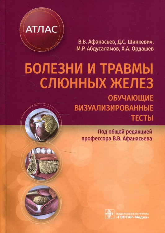 Болезни и травмы слюнных желез. Обучающие визуализированные тесты. Атлас