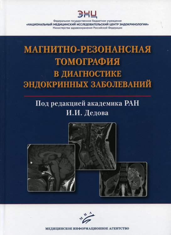 Магнитно-резонансная томография в диагностике эндокринных заболеваний