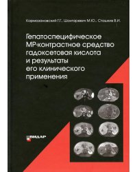 Гепатоспецифическое МР-контрастное средство &quot;гадоксетовая кислота&quot; и результаты его клинического применения