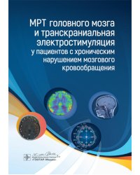 МРТ головного мозга и транскраниальная электростимуляция у пациентов с хроническим нарушением