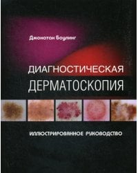 Диагностическая дерматоскопия. Иллюстрированное руководство