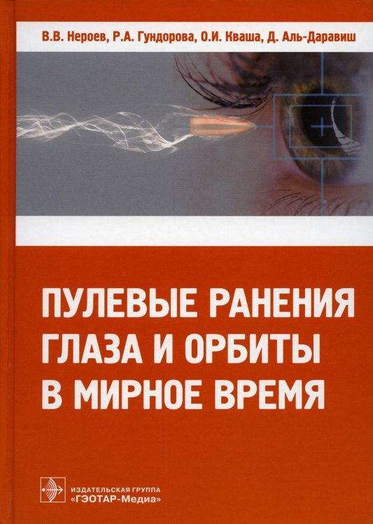 Пулевые ранения глаза и орбиты в мирное время