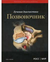 Лучевая диагностика. Позвоночник