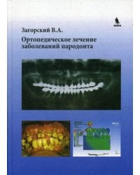 Ортопедическое лечение заболеваний пародонта