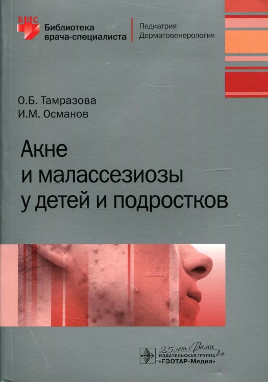 Акне и малассезиозы у детей и подростков