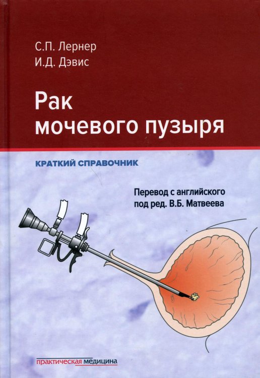 Рак мочевого пузыря. Краткий справочник