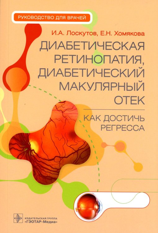 Диабетическая ретинопатия, диабетический макулярный отек - как достичь регресса. Руководство