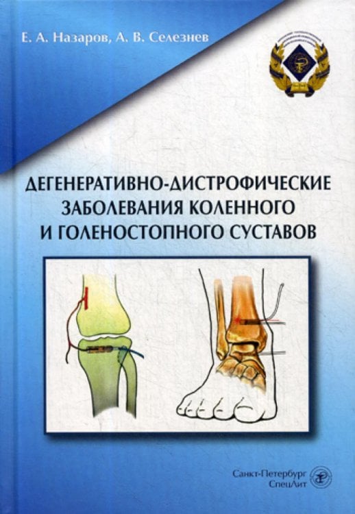 Дегенеративно-дистрофические заболевания коленного и голеностопного суставов