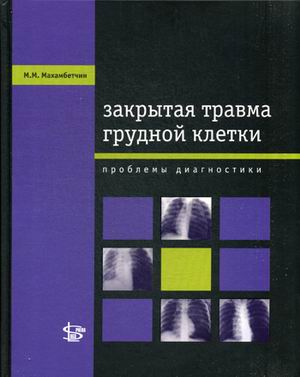 Закрытая травма грудной клетки. Проблемы диагностики