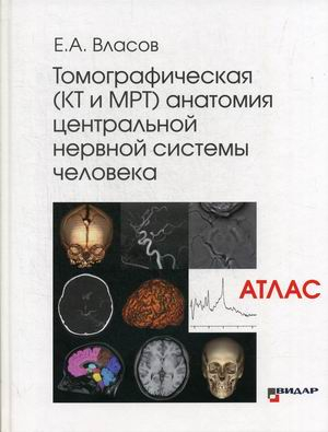 Томографическая (КТ и МРТ) анатомия центральной нервной системы человека. Атлас