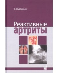 Реактивные артриты