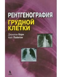 Рентгенография грудной клетки