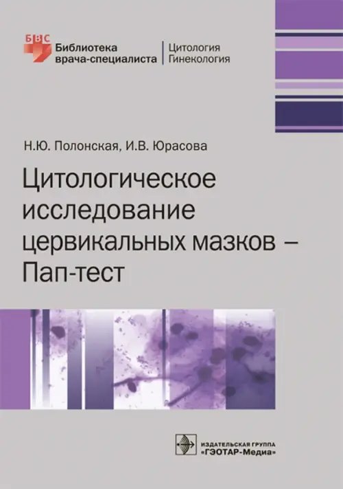 Цитологическое исследование цервикальных мазков