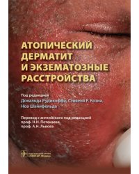 Атопический дерматит и экзематозные расстройства