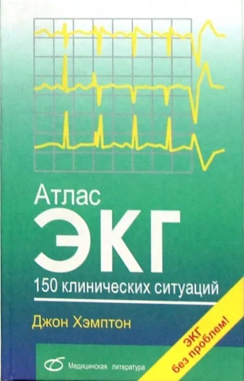 Атлас ЭКГ. 150 клинических ситуаций