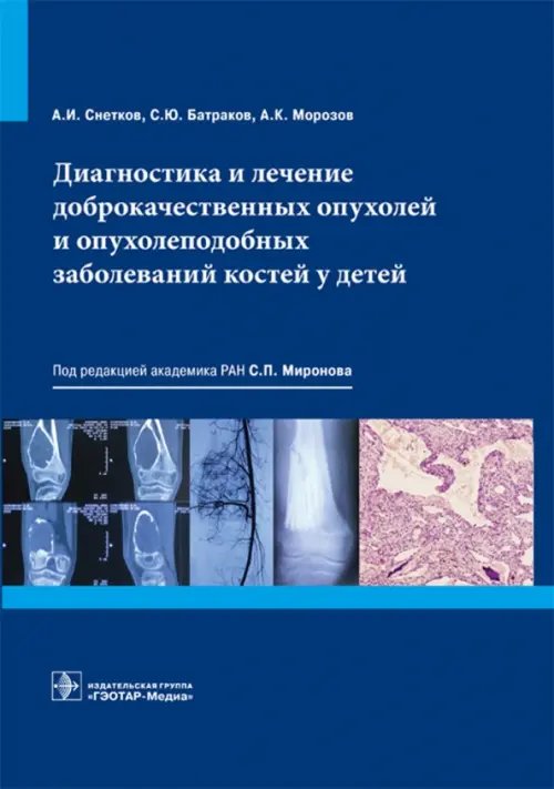 Диагностика и лечение доброкачественных опухолей и опухолеподобных заболеваний костей у детей