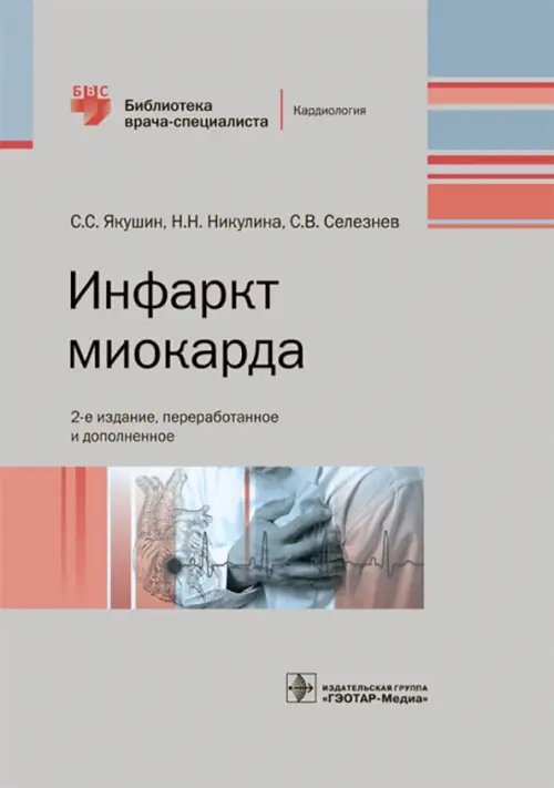 Инфаркт миокарда. Руководство