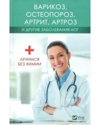 Варикоз, остеопороз, артрит, артроз и другие заболевания ног. Лечимся без химии