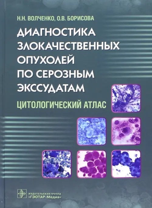 Диагностика злокачественных опухолей по серозным экссудатам. Цитологический атлас