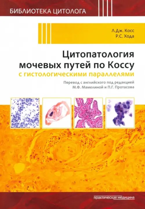 Цитопатология мочевых путей по Коссу с гистологическими параллелями