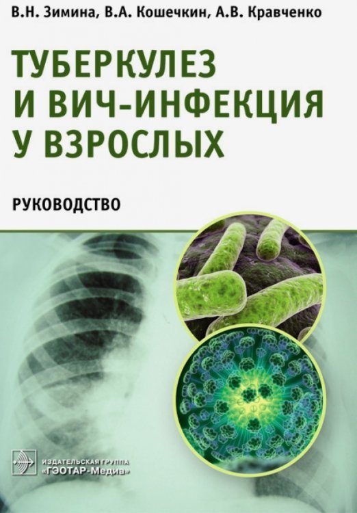 Туберкулез и ВИЧ-инфекция у взрослых. Руководство