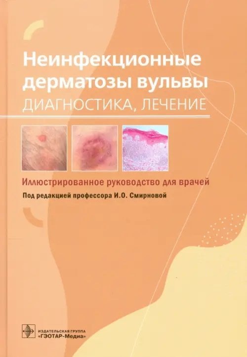 Неинфекционные дерматозы вульвы. Диагностика, лечение. Иллюстрированное руководство