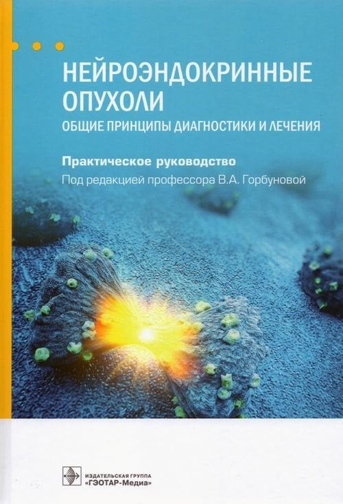 Нейроэндокринные опухоли. Общие принципы диагностики и лечения. Руководство