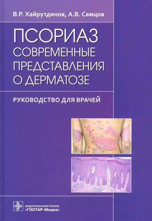 Псориаз. Современные представления о дерматозе. Руководство для врачей