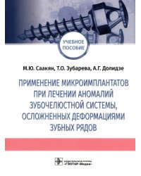 Применение микроимплантатов при лечении аномалий зубочелюстной системы, осложненных деформациями