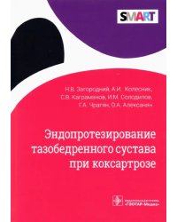 Эндопротезирование тазобедренного сустава при коксартрозе