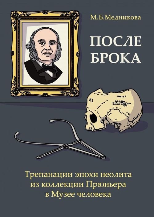 После Брока. Трепанации эпохи неолита из коллекции Прюньера в Музее Человека в Париже