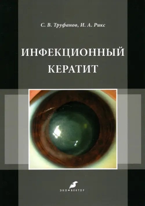 Инфекционный кератит. Учебное пособие