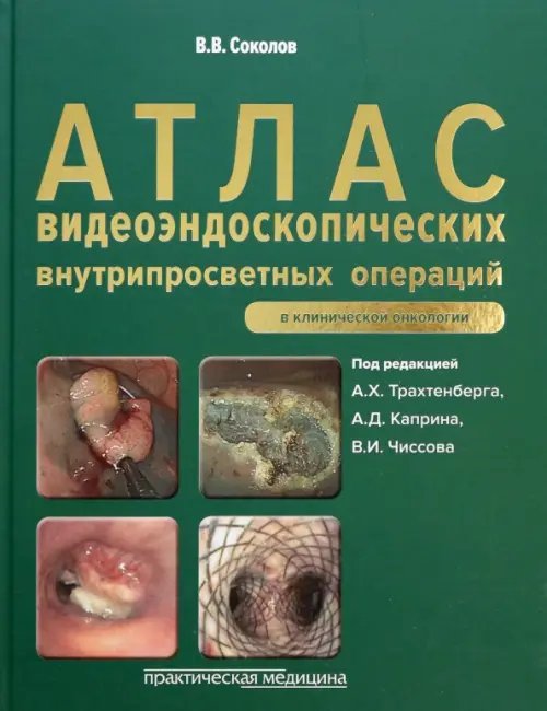 Атлас видеоэндоскопических внутрипросветных операций в клинической онкологии